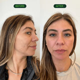 Vitaclean Wall Mount Shower Head Starter Kit Starter Kit Chrome