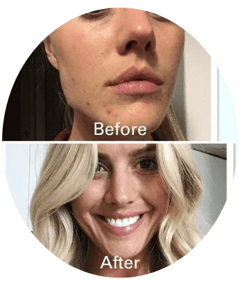 The Zoe Report: 10 Blonde Hair Maintenance Products That Help When I Can’t See My Coloris